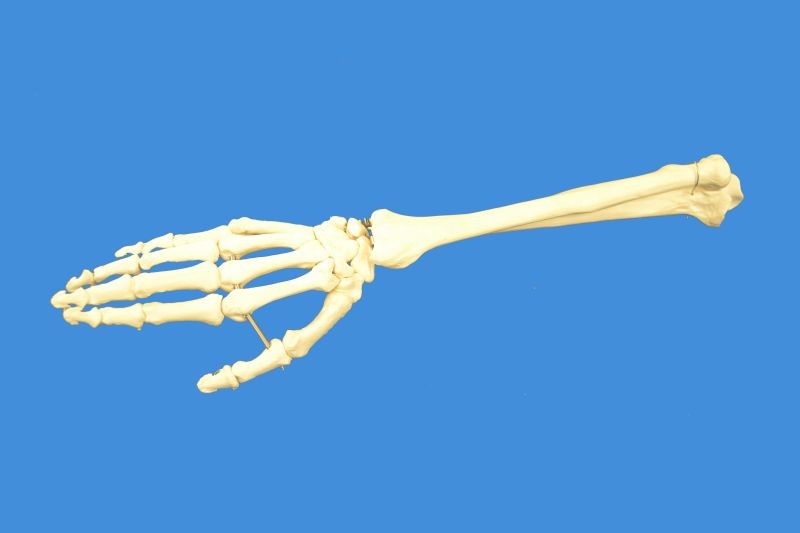 Human Right Hand with Ulna and Radius Skeleton Model, Life Size  
