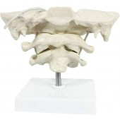 Anatomical Occipital Bone,  Atlas Axis (C1 & C2),  W/Base, 1.5X Enlarged, Rotable